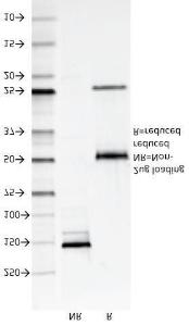 SDS-PAGE analysis of Anti-CD147 Antibody [8D6] under non-reduced and reduced conditions; showing intact IgG and intact heavy and light chains, respectively. SDS-PAGE analysis confirms the integrity and purity of the antibody