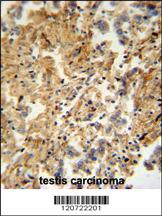 Anti-RM50 Rabbit Polyclonal Antibody