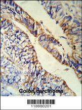 Anti-PCSK9 Rabbit Polyclonal Antibody