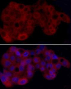 Immunofluorescence analysis of HepG2 using Anti-Heme Oxygenase 1 Antibody (A307279) at dilution of 1 : 50 (40X lens). DAPI was used to stain the cell nuclei (blue)