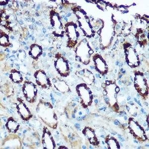 Immunohistochemistry analysis of paraffin-embedded rat kidney using Anti-HSP60 Antibody (A12728) at a dilution of 1:100 (40X lens). Perform microwave antigen retrieval with 10 mM Tris/EDTA buffer pH 9.0 before commencing with IHC staining protocol