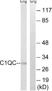 Western blot analysis of lysates from rat lung using Anti-C1QC Antibody. The right hand lane represents a negative control, where the antibody is blocked by the immunising peptide.