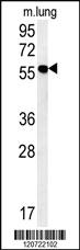 Anti-RM50 Rabbit Polyclonal Antibody