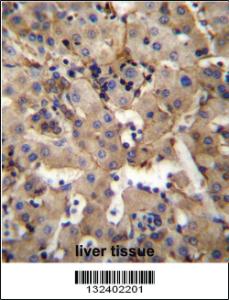 Anti-HTR2B Rabbit Polyclonal Antibody