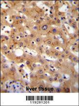 Anti-GGCX Rabbit Polyclonal Antibody