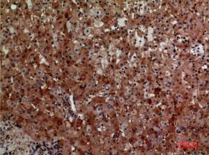 Immunohistochemical analysis of paraffin-embedded human liver using Anti-CD276 Antibody