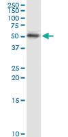 Anti-CK15 Rabbit Polyclonal Antibody