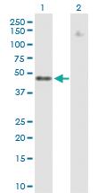 Anti-ZNF776 Mouse Polyclonal Antibody