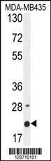 Anti-M4A4A Rabbit Polyclonal Antibody (AP (Alkaline Phosphatase))