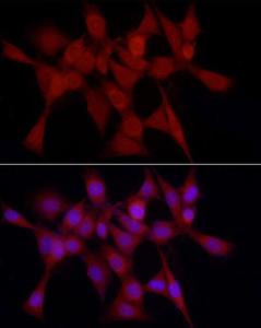 Immunofluorescence analysis of NIH-3T3 using Anti-Heme Oxygenase 1 Antibody (A307279) at dilution of 1 : 50 (40X lens). DAPI was used to stain the cell nuclei (blue)