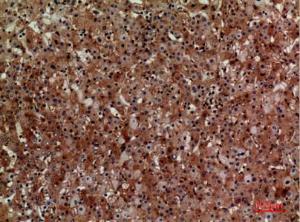 Immunohistochemical analysis of paraffin-embedded human liver using Anti-CD276 Antibody