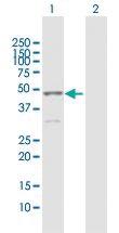 Anti-CK15 Rabbit Polyclonal Antibody