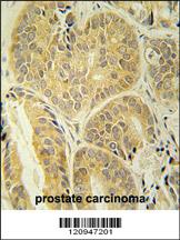 Anti-TMEM18 Rabbit Polyclonal Antibody