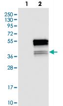 Anti-C22ORF29 Rabbit Polyclonal Antibody