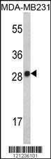 Anti-IL2 Rabbit Polyclonal Antibody (Biotin)