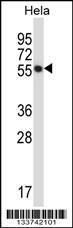 Anti-CSK Rabbit Polyclonal Antibody (APC (Allophycocyanin))