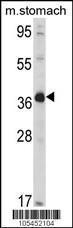 Anti-NAGK Rabbit Polyclonal Antibody (FITC (Fluorescein Isothiocyanate))