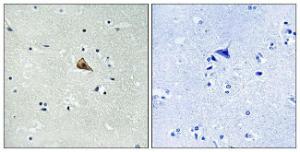 Immunohistochemical analysis of paraffin-embedded human brain using Anti-Trk A (phospho Tyr701) Antibody. The right hand panel represents a negative control, where the antibody was pre-incubated with the immunising peptide