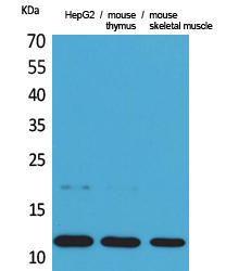 Anti-CCL11 antibody