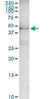 Anti-CK15 Rabbit Polyclonal Antibody