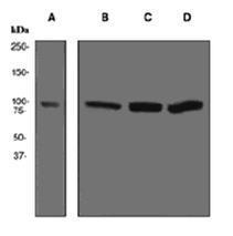 Anti-ACTN4 Rabbit Monoclonal Antibody [clone: 13A151]