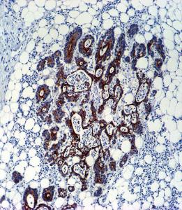 Anti-TGFB2 Mouse Monoclonal Antibody (HRP (Horseradish Peroxidase)) [clone: 220ct16.4.3.1]