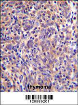 Anti-THEMIS Rabbit Polyclonal Antibody