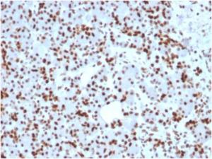 Anti-SOX9 antibody