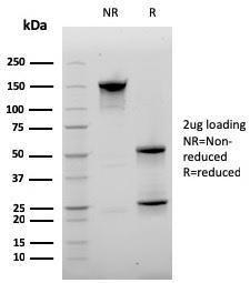 Anti-CD20 antibody