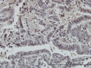 Anti-FOXO3 Mouse Monoclonal Antibody [clone: 3C2]