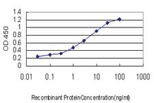 Anti-YWHAH Mouse Monoclonal Antibody [clone: 6A12]