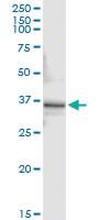 Anti-PEX10 Antibody Pair