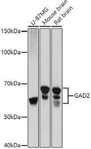 Western blot analysis of extracts of various cell lines, using Anti-GAD65 Antibody (A12729) at 1:1000 dilution