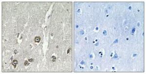 Immunohistochemical analysis of paraffin-embedded human brain using Anti-ACOT8 Antibody 1:100 (4 °C overnight). The right hand panel represents a negative control, where the Antibody was pre-incubated with the immunising peptide