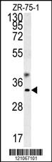 Anti-GCH1 Rabbit Polyclonal Antibody