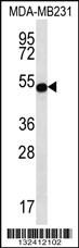 Anti-STAP2 Rabbit Polyclonal Antibody