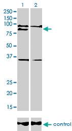 Anti-RNF141 Mouse Monoclonal Antibody [clone: 6D9]