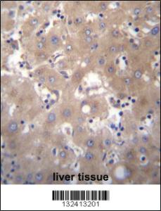 Anti-SIX5 Rabbit Polyclonal Antibody