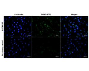 Immunofluorescence analysis of BDNF expression in rat C6 glioma cells.