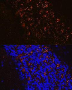 Immunofluorescence analysis of rat brain cells using Anti-GAD65 Antibody (A12729) at a dilution of 1:100 (40x lens). DAPI was used to stain the cell nuclei (blue)