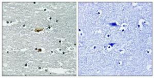 Immunohistochemical analysis of paraffin-embedded human brain using Anti-STK39 (phospho Ser311) Antibody. The right hand panel represents a negative control, where the antibody was pre-incubated with the immunising peptide.