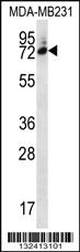 Anti-SIX5 Rabbit Polyclonal Antibody