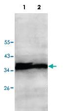 Anti-ECH1 Rabbit Polyclonal Antibody