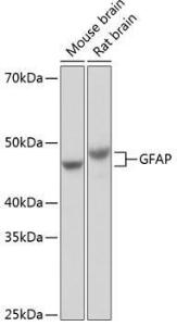 Anti-GFAP Rabbit Monoclonal Antibody [clone: ARC0206]