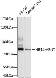 Western blot analysis of extracts of various cell lines, using Anti-HIF1 beta Antibody (A12730) at 1:1000 dilution