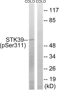 Western blot analysis of lysates from COLO205 cells using Anti-STK39 (phospho Ser311) Antibody. The right hand lane represents a negative control, where the antibody is blocked by the immunising peptide.