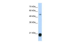 Anti-CBX3 Rabbit Polyclonal Antibody