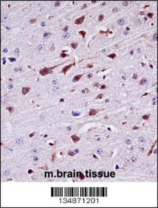 Anti-PTK2B Rabbit Polyclonal Antibody (FITC (Fluorescein Isothiocyanate))