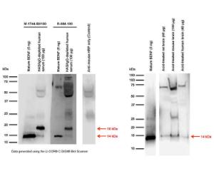 Left: Western blot analysis of BDNF expression in HSA- and IgG-depleted human serum. <br />Right: Western blot analysis of BDNF expression in acid-treated rodent and human brain samples. Brain samples were acid-treated at pH 4 (refer to References for a detailed extraction method protocol).