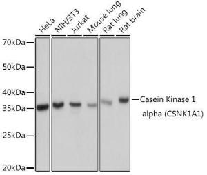 Western blot analysis of extracts of various cell lines, using Anti-Casein Kinase 1 alpha Antibody [ARC1860] (A305735) at 1:1,000 dilution. The secondary antibody was Goat Anti-Rabbit IgG H&L Antibody (HRP) at 1:10,000 dilution.